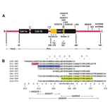 Epitope Diagram - Anti-NF-L Antibody [6H112] (A270560) - Antibodies.com