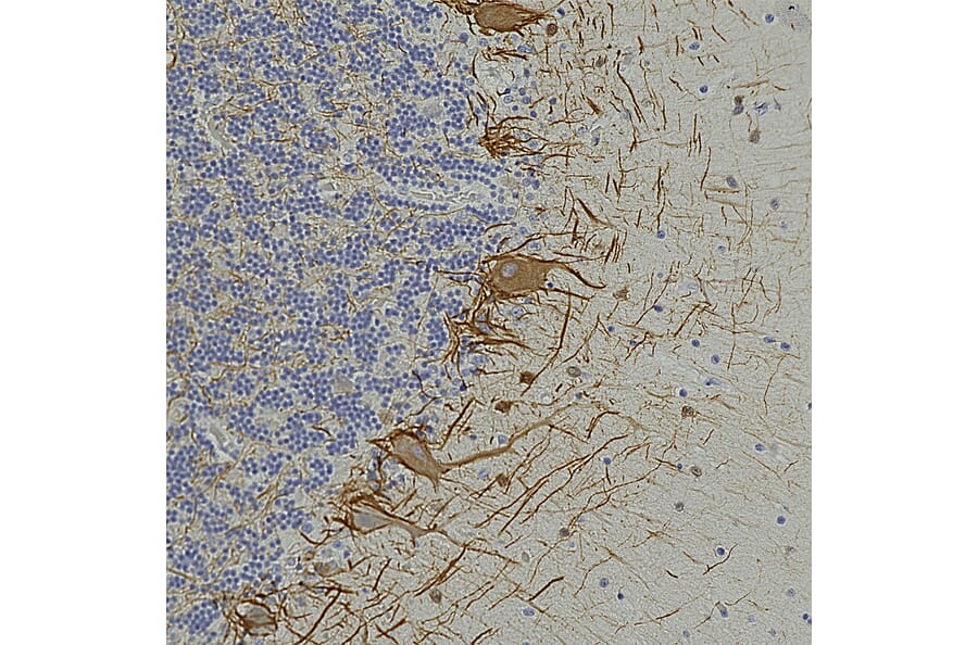 Immunohistochemistry - Anti-NF-L Antibody [6H112] (A270560) - Antibodies.com