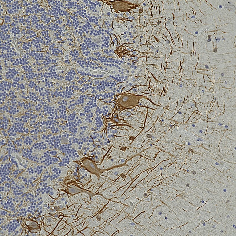 Immunohistochemistry - Anti-NF-L Antibody [6H112] (A270560) - Antibodies.com