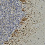 Immunohistochemistry - Anti-NF-L Antibody [6H112] (A270560) - Antibodies.com