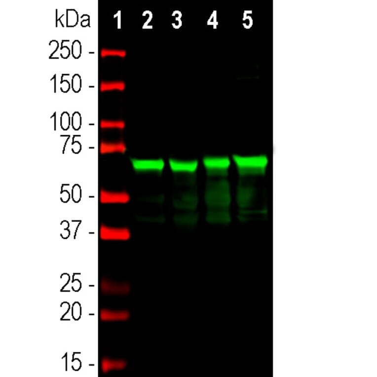Western Blot - Anti-NF-L Antibody [6H112] (A270560) - Antibodies.com