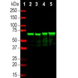 Western Blot - Anti-NF-L Antibody [6H112] (A270560) - Antibodies.com
