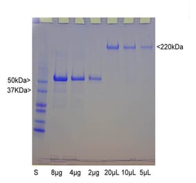 SDS-PAGE - Native Bovine Neurofilament Heavy Polypeptide Protein (A270563) - Antibodies.com