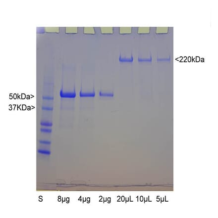 SDS-PAGE - Native Bovine Neurofilament Heavy Polypeptide Protein (A270563) - Antibodies.com