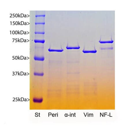 SDS-PAGE - Recombinant Human alpha Internexin Protein (A270567) - Antibodies.com