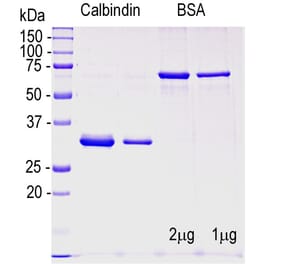 SDS-PAGE - Recombinant Human Calbindin Protein (A270568) - Antibodies.com