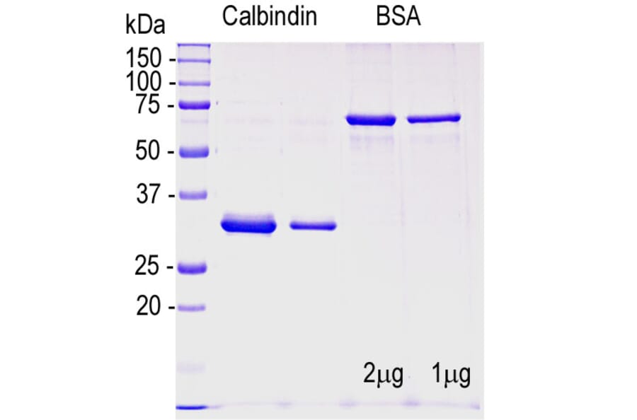 SDS-PAGE - Recombinant Human Calbindin Protein (A270568) - Antibodies.com