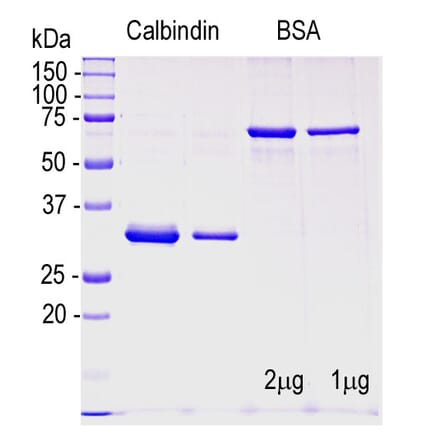 SDS-PAGE - Recombinant Human Calbindin Protein (A270568) - Antibodies.com