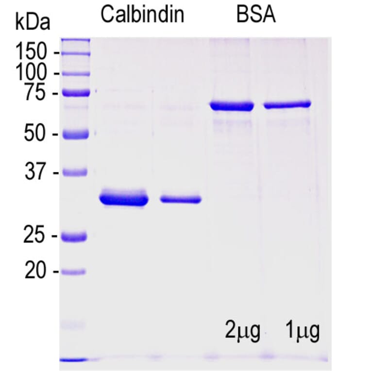 SDS-PAGE - Recombinant Human Calbindin Protein (A270568) - Antibodies.com