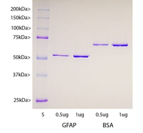 SDS-PAGE - Recombinant Human GFAP Protein (A270569) - Antibodies.com
