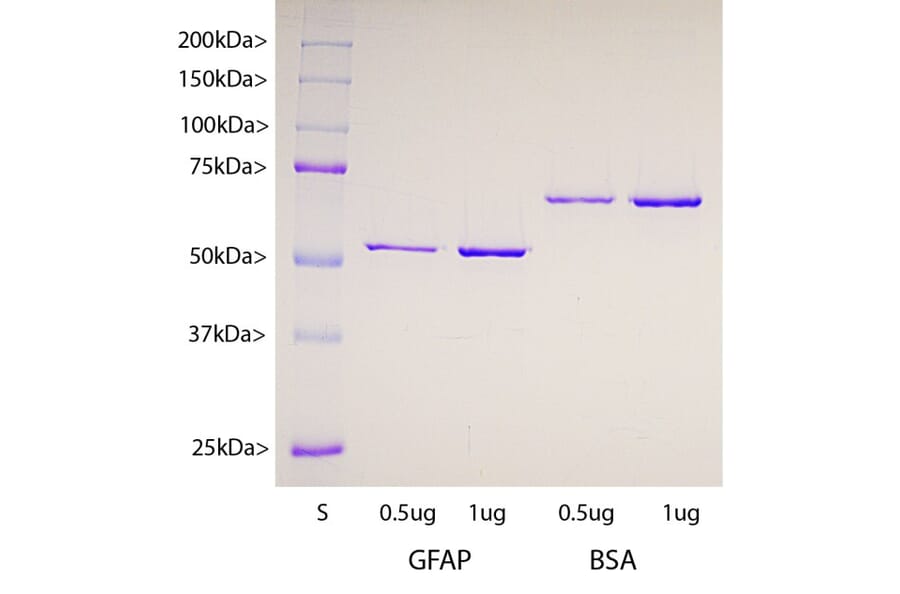 SDS-PAGE - Recombinant Human GFAP Protein (A270569) - Antibodies.com