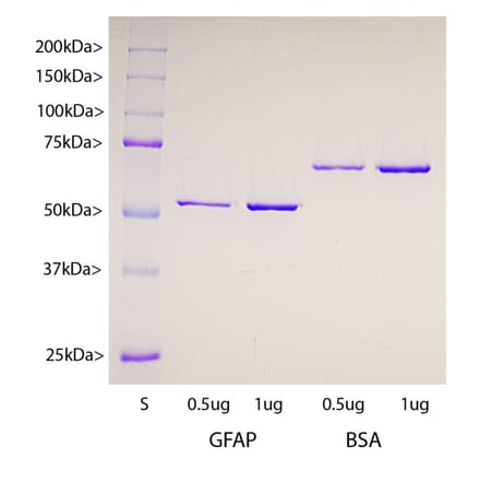 SDS-PAGE - Recombinant Human GFAP Protein (A270569) - Antibodies.com