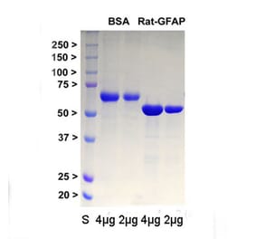 SDS-PAGE - Recombinant Rat GFAP Protein (A270570) - Antibodies.com