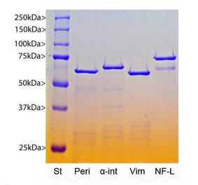 SDS-PAGE - Recombinant Human 68kDa Neurofilament Protein (A270573) - Antibodies.com