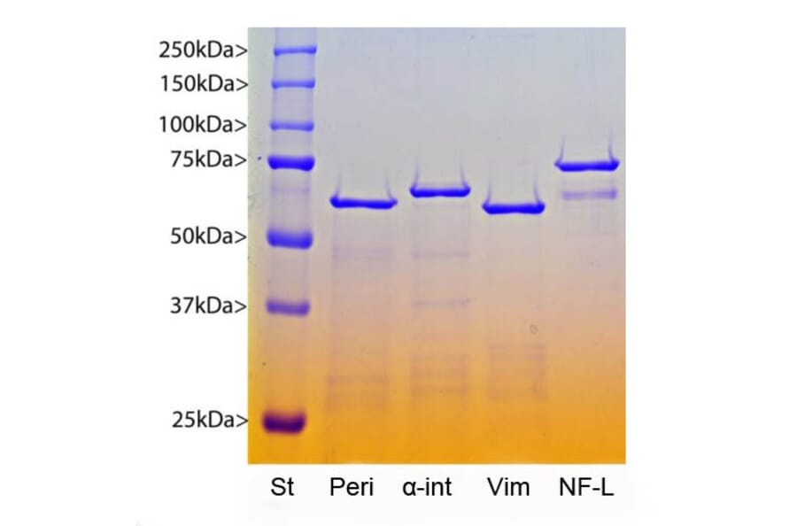 SDS-PAGE - Recombinant Human Peripherin Protein (A270574) - Antibodies.com