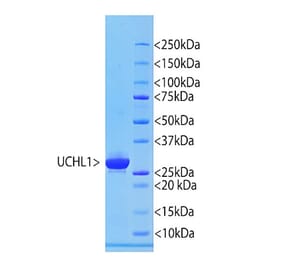 SDS-PAGE - Recombinant Human PGP9.5 Protein (A270577) - Antibodies.com