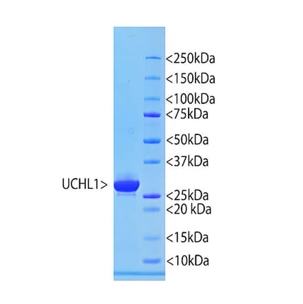 SDS-PAGE - Recombinant Human PGP9.5 Protein (A270577) - Antibodies.com