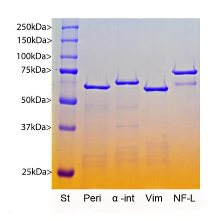 SDS-PAGE - Recombinant Human Vimentin Protein (A270578) - Antibodies.com