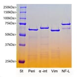 SDS-PAGE - Recombinant Human Vimentin Protein (A270578) - Antibodies.com