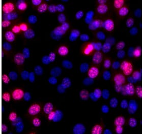 Immunofluorescence - Anti-Ki67 Antibody (A270579) - Antibodies.com