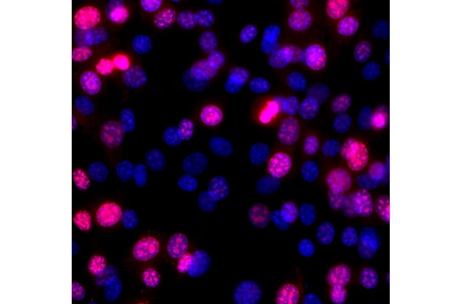 Immunofluorescence - Anti-Ki67 Antibody (A270579) - Antibodies.com