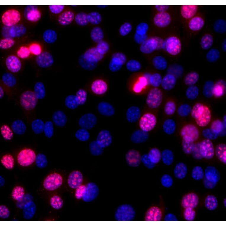 Immunofluorescence - Anti-Ki67 Antibody (A270579) - Antibodies.com