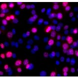 Immunofluorescence - Anti-Ki67 Antibody (A270579) - Antibodies.com