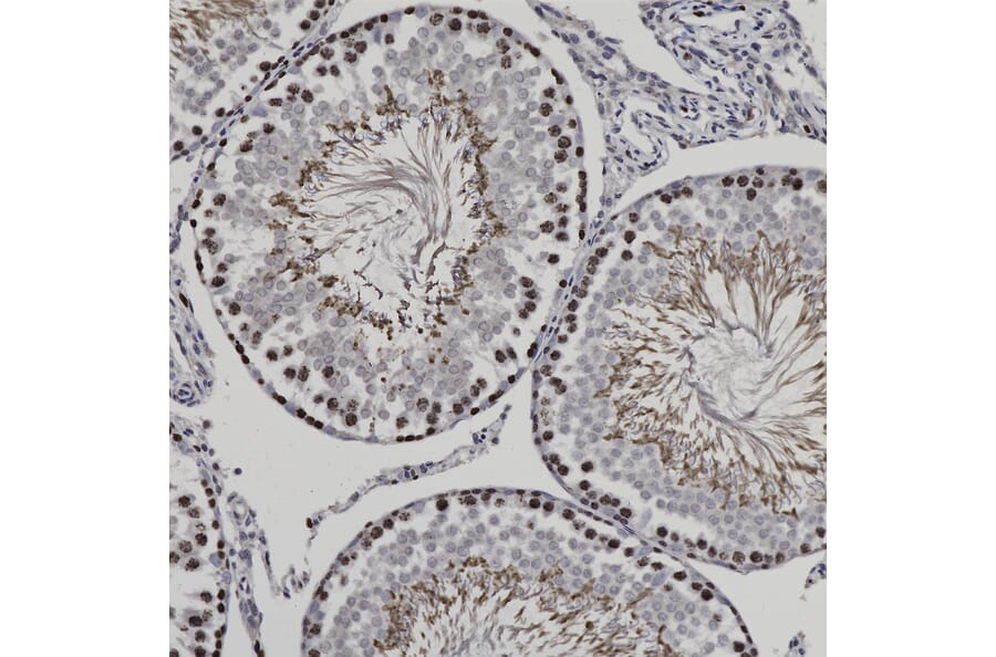 Immunohistochemistry - Anti-Ki67 Antibody (A270579) - Antibodies.com