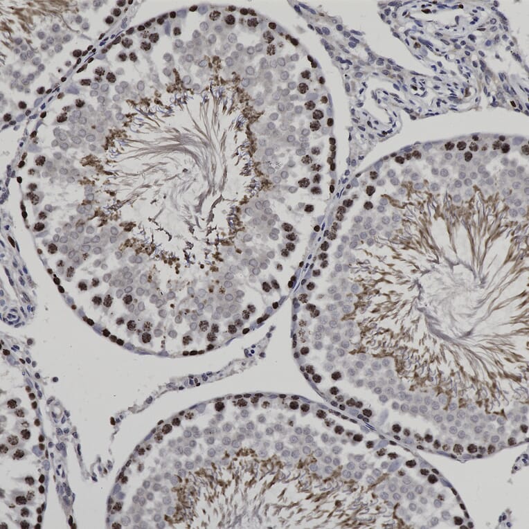 Immunohistochemistry - Anti-Ki67 Antibody (A270579) - Antibodies.com