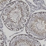Immunohistochemistry - Anti-Ki67 Antibody (A270579) - Antibodies.com