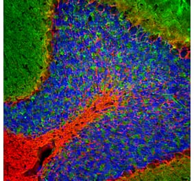 Immunofluorescence - Anti-NF-L Antibody (A270580) - Antibodies.com
