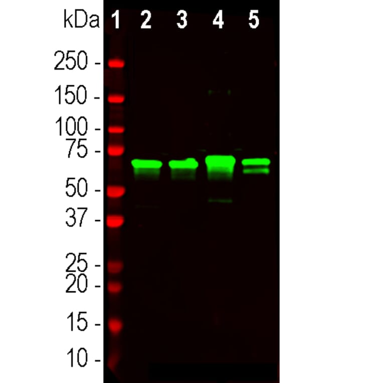 Western Blot - Anti-NF-L Antibody (A270580) - Antibodies.com