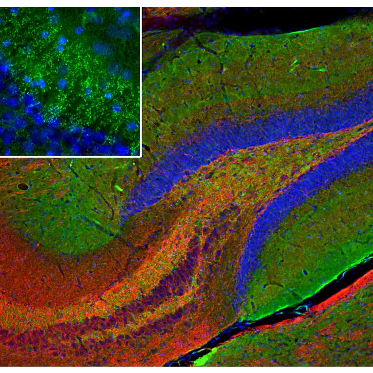 Immunofluorescence - Anti-NF-L Antibody (A270580) - Antibodies.com