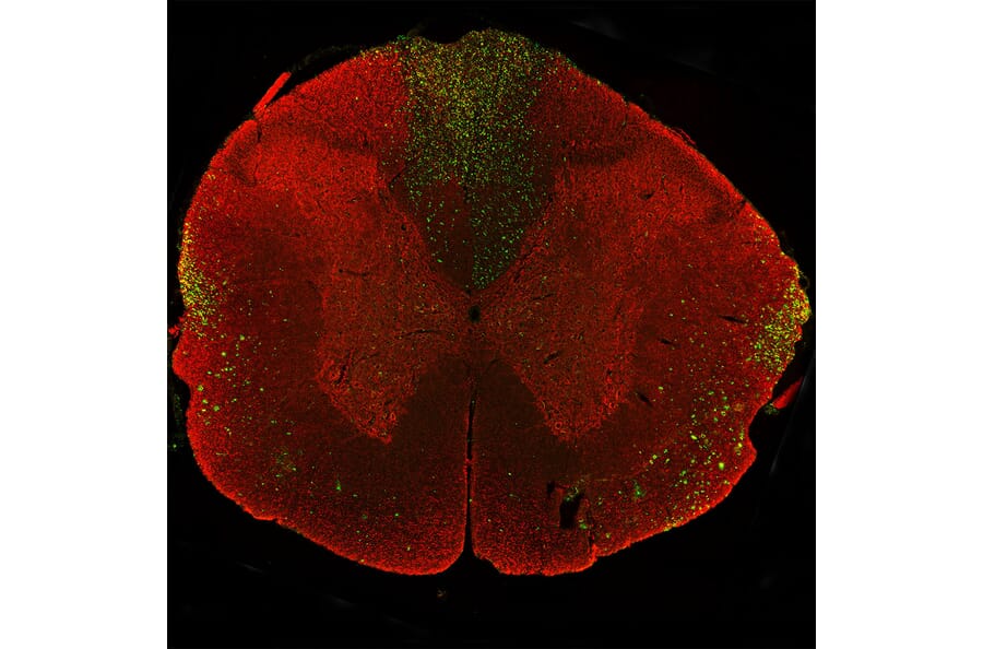 Immunofluorescence - Anti-NF-L Antibody (A270580) - Antibodies.com