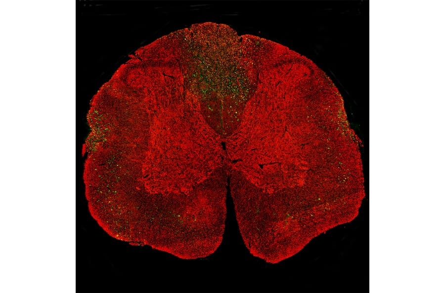 Immunofluorescence - Anti-NF-L Antibody (A270580) - Antibodies.com