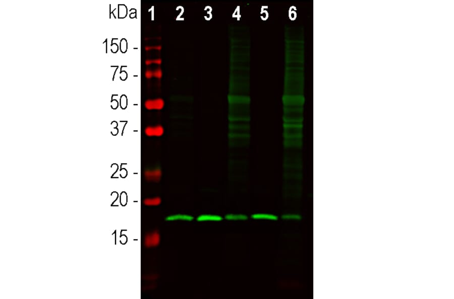 Western Blot - Anti-beta Synuclein Antibody (A270581) - Antibodies.com