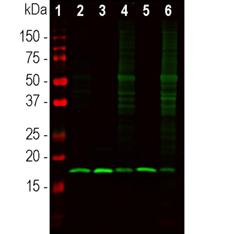 Western Blot - Anti-beta Synuclein Antibody (A270581) - Antibodies.com