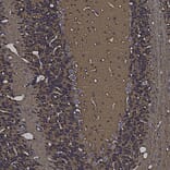 Immunohistochemistry - Anti-beta Synuclein Antibody (A270581) - Antibodies.com