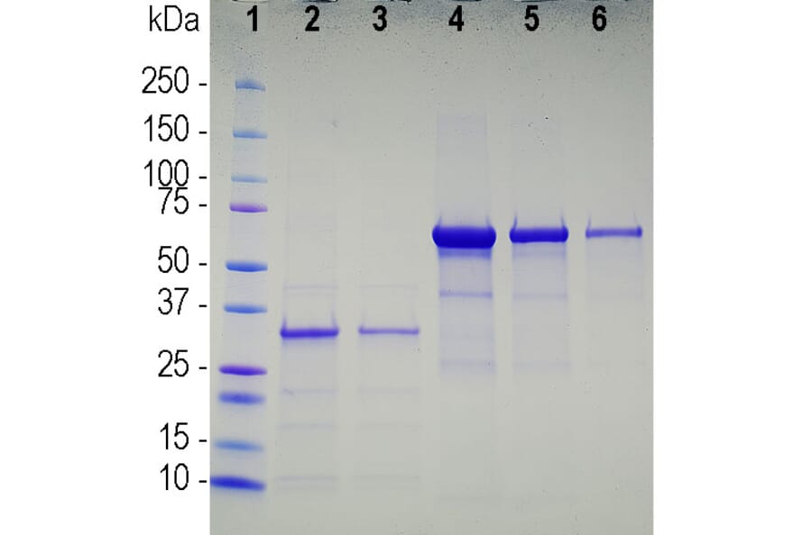 SDS-PAGE - Recombinant SARS-CoV-2 Spike Glycoprotein (A270591) - Antibodies.com