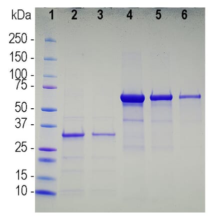 SDS-PAGE - Recombinant SARS-CoV-2 Spike Glycoprotein (A270591) - Antibodies.com