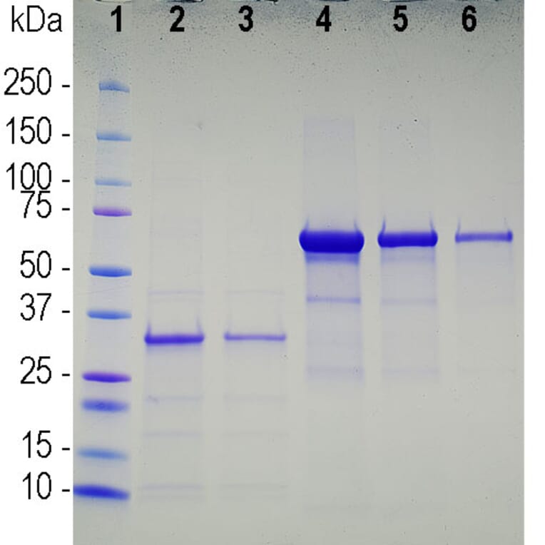 SDS-PAGE - Recombinant SARS-CoV-2 Spike Glycoprotein (A270591) - Antibodies.com