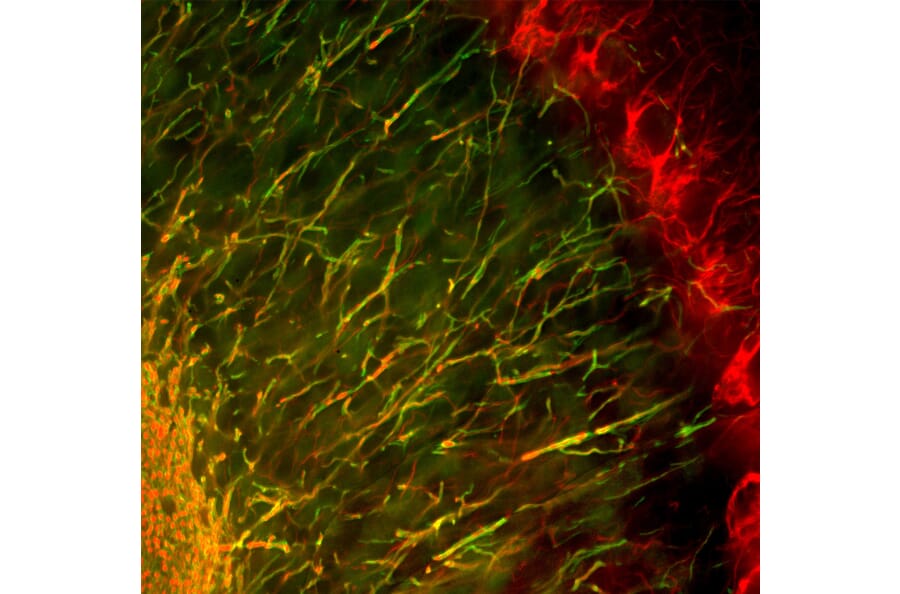 Immunofluorescence - Anti-NF-H Antibody (A270594) - Antibodies.com
