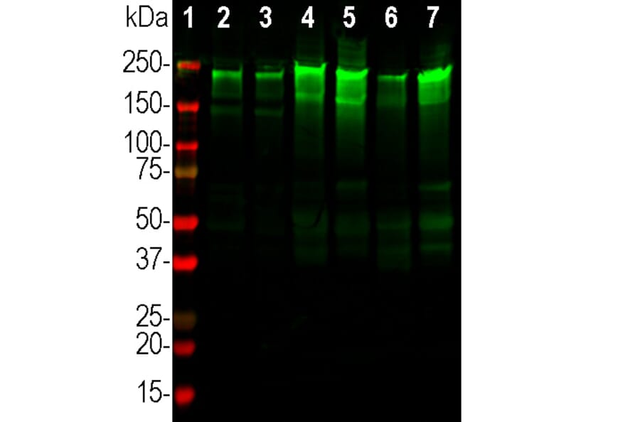 Western Blot - Anti-NF-H Antibody (A270594) - Antibodies.com