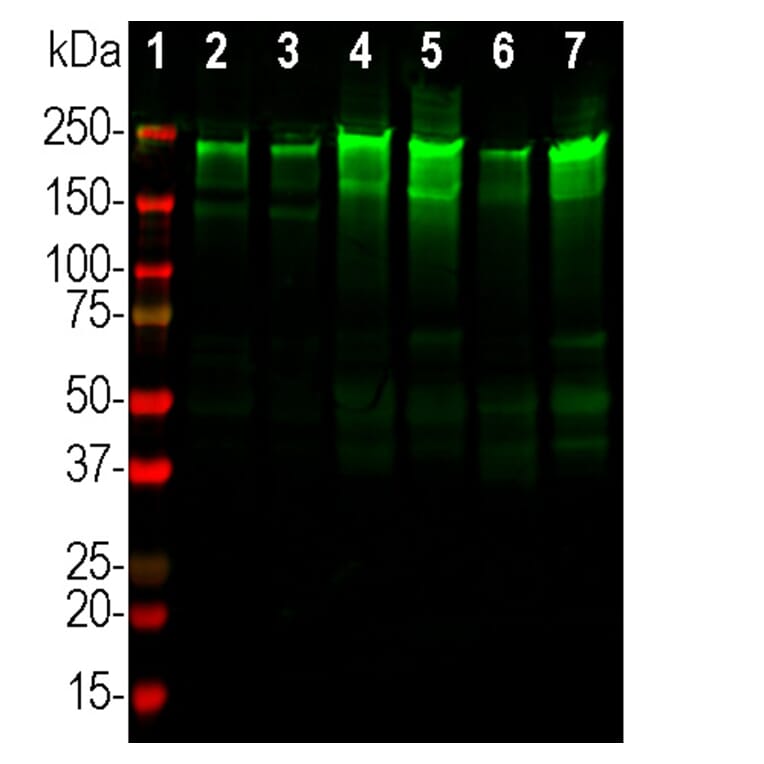 Western Blot - Anti-NF-H Antibody (A270594) - Antibodies.com