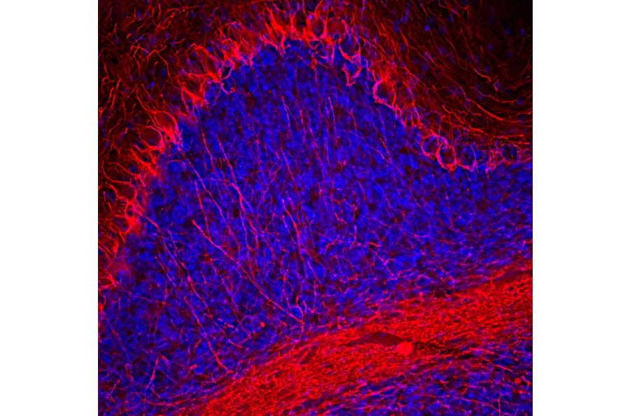 Immunofluorescence - Anti-NF-H Antibody (A270594) - Antibodies.com