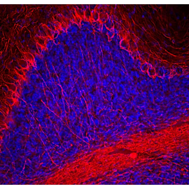 Immunofluorescence - Anti-NF-H Antibody (A270594) - Antibodies.com