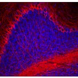 Immunofluorescence - Anti-NF-H Antibody (A270594) - Antibodies.com