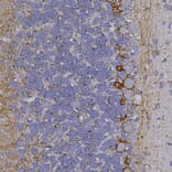 Immunohistochemistry - Anti-NF-H Antibody (A270594) - Antibodies.com