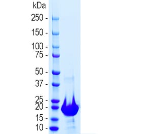 SDS-PAGE - Recombinant Human Neurofilament Light Polypeptide (A270596) - Antibodies.com