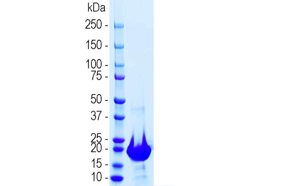 SDS-PAGE - Recombinant Human NF-L Polypeptide (A270596) - Antibodies.com